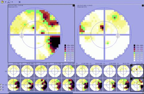 EyeSuite_Screen